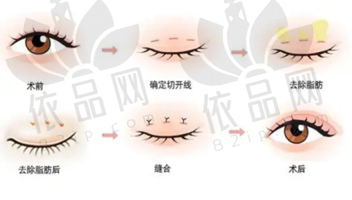 三、擅长领域：全方面解决眼部问题