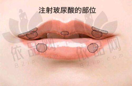 常州武进施尔美医疗美容医院预约方式