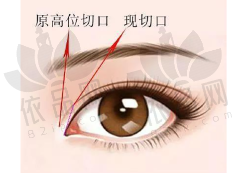 NO.4 武汉大学中南医院整形美容科