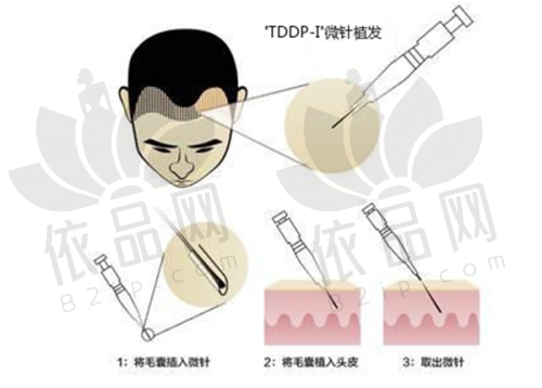 徐州医 科汇美美容医院植发科正规吗