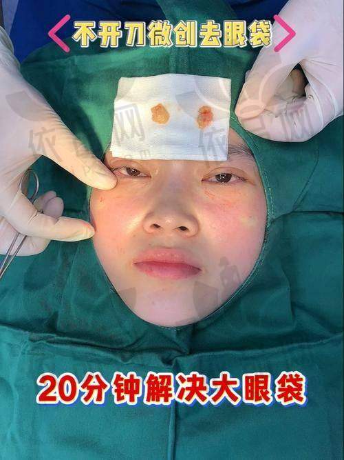 一、冯少清眼部整形价格表：不同项目费用差异在哪？
