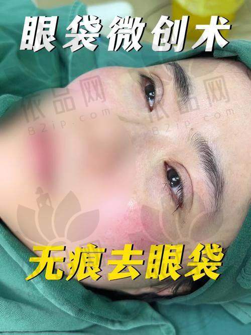 三、冯少清眼修复费用解析：为何比初眼贵50%？