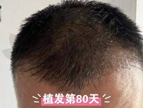 徐州医 科汇美美容医院植发科医生团队