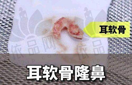 常州曙光医疗美容医院预约方式