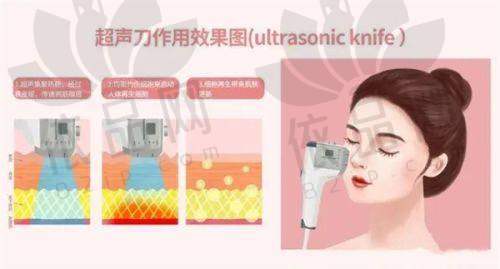 徐州李刚医疗美容——价格公开透明，无隐形消费