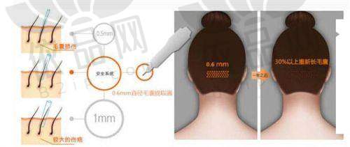 苏州名仕医院植发中 心营业时间
