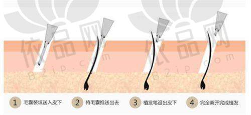 实例分享：见证真实改变