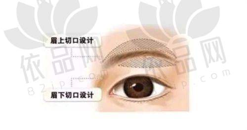 微创变得更美修复快：徐州李刚医生操作细致，轻松度过修复期