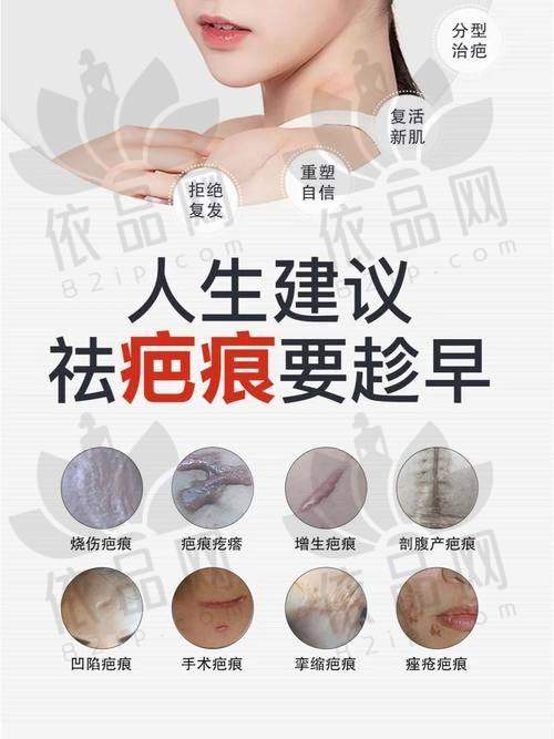 苏州乐桥疤痕专科正规吗