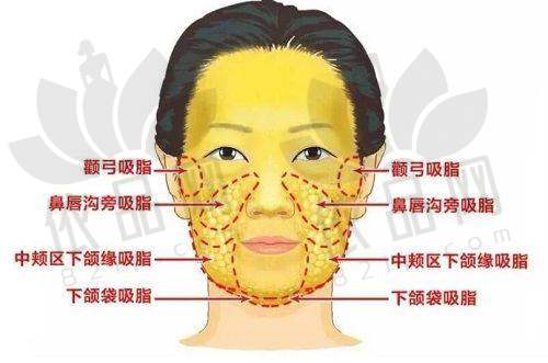 苏州美贝尔美容医院赵晓晖医生——口碑评价