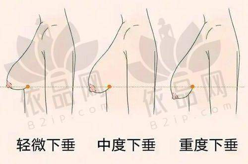 昆山嘉美奥医疗美容诊所医院收费价格表
