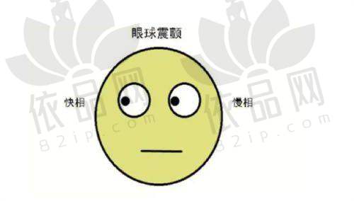 苏州光明眼科医院正规吗
