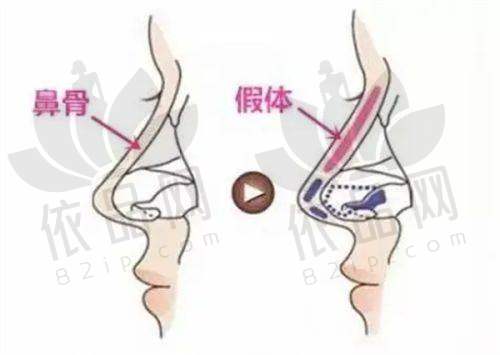 苏州工业园区艺德雅医疗美容诊所正规吗