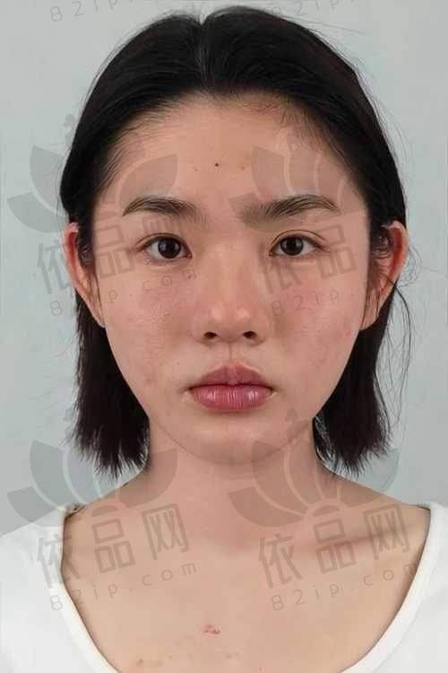苏州紫馨美容医院陈丹丹医生简介