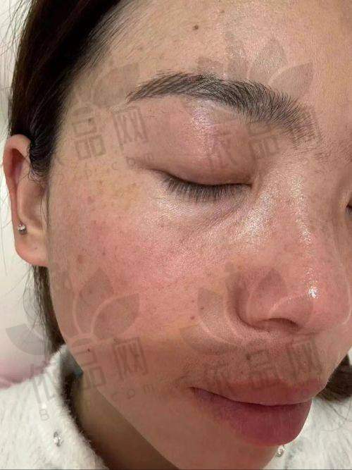 常州曙光整形祛斑价格