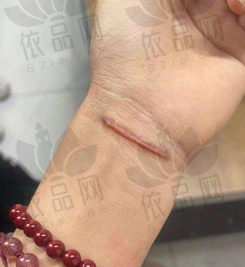 总结