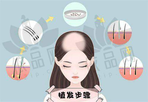 连云港新丝梵倍速植发门诊部怎么样