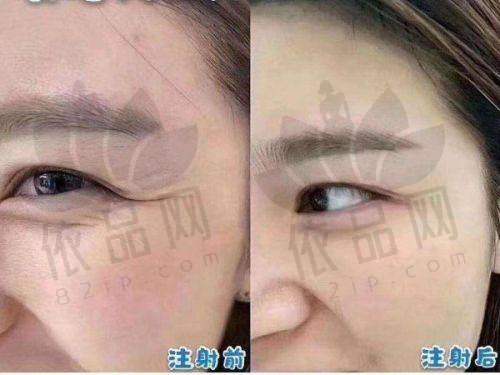 适合人群