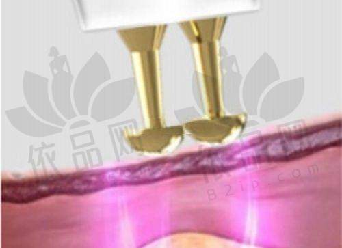 不同原因导致的馒化脸修复价格