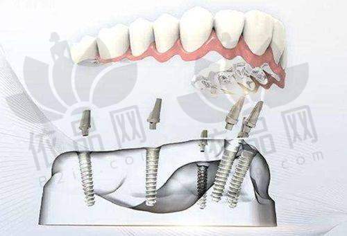 淮安涟水艾可维口腔诊所医生团队