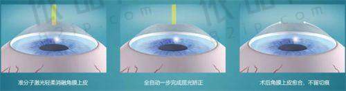 三、避坑指南 + 省钱攻略