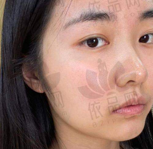 黄金超光子的核心功效