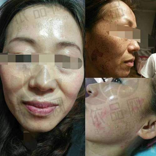 济南诺德医疗美容医院：医生操作稳妥，技术成体系