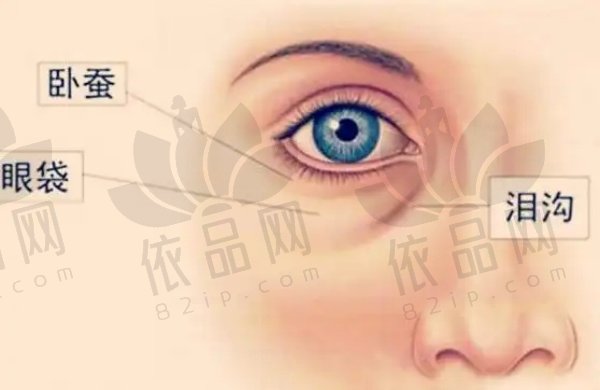 合肥去眼袋top5医院排名揭晓！壹加壹、艺星等技术好可放心选