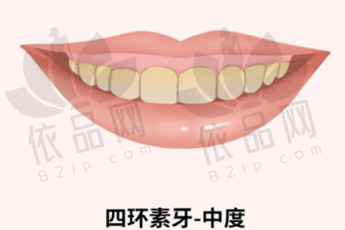 2025上海正畸私立医院TOP10推荐，附明星医生与牙齿矫正价格表