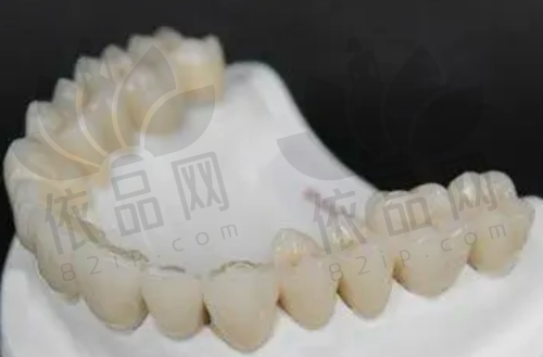 劲松口腔牡丹园店种牙技术出色，电话010***88等多方式可预约