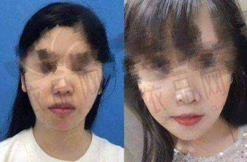 南通初颜医疗美容黄忠医生特色技术优势