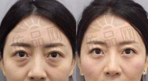 二、沈阳杏林隆鼻整形价格参考