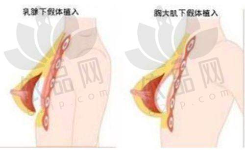 淮安千姿薇医疗美容门诊部医院收费价格表