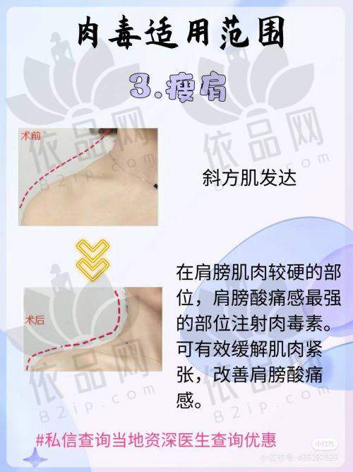 盐城东方女子医院医疗美容科预约方式