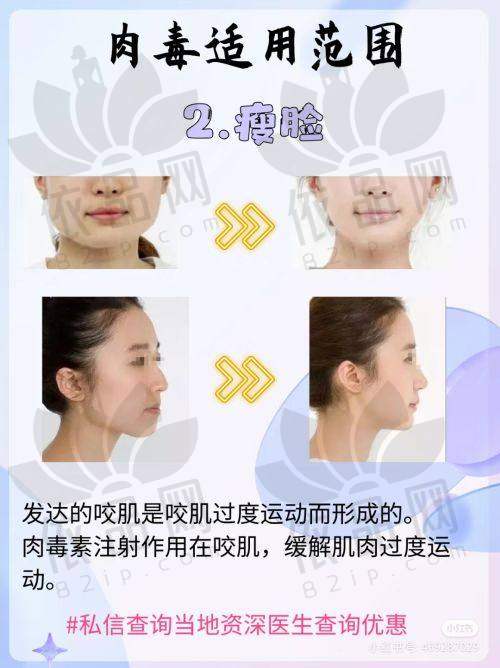 连云港媚眼医疗美容王飞医生：擅长项目