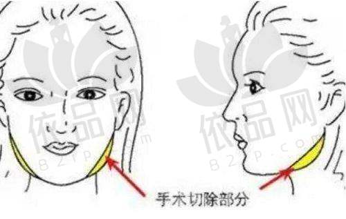 徐金苹医生擅长项目