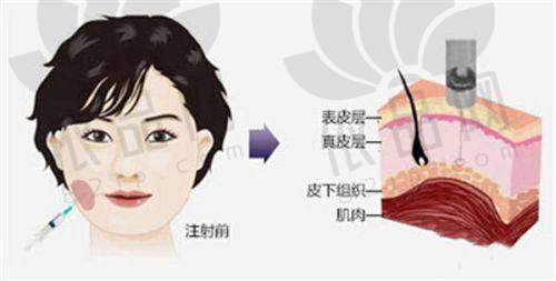盐城华韩黄金超光子的独特优势