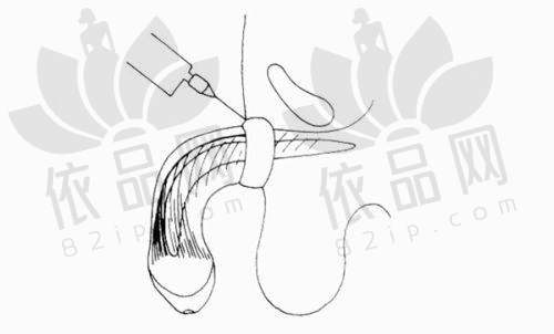 光子嫩肤项目价格