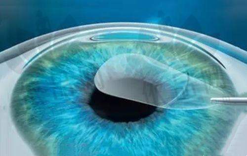 二、同仁眼科魏文斌挂号方式