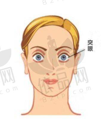 三、其他眼科手术收费