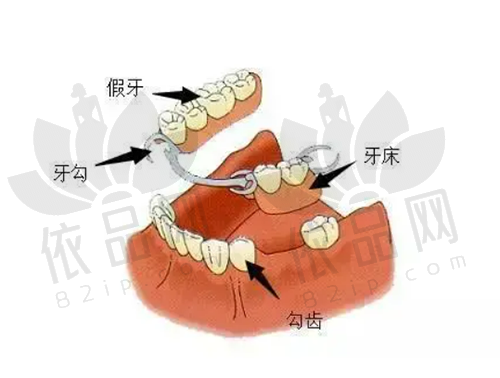 杭州美奥口腔安卓健种植牙低至5980元起/颗，新技术缩短周期，半口微创精准快速！