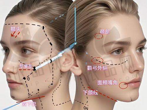 4、国内做双眼皮修复医生——师丽丽医生