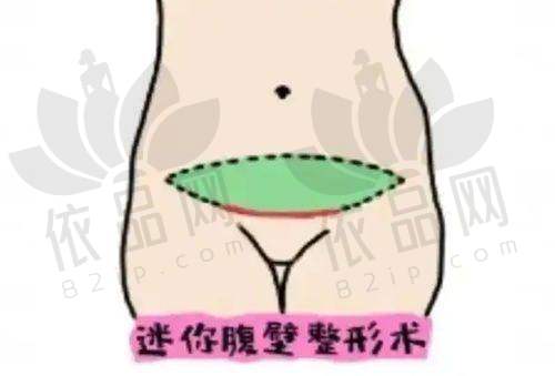 宿迁奕美美容医院张浩医生 - 擅长项目