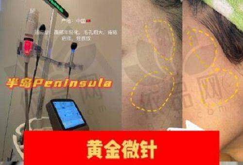 杭州广仁医院女性私密中 心：正规吗