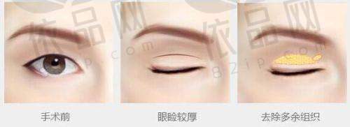 三、预约注意事项