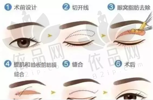 杭州伊甸媛医疗美容诊所：结语