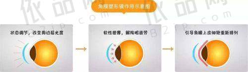 （二）白内障收费：3000元 - 23000元起