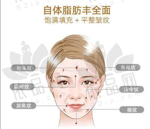 杭州菁漾医疗美容诊所 收费价格表