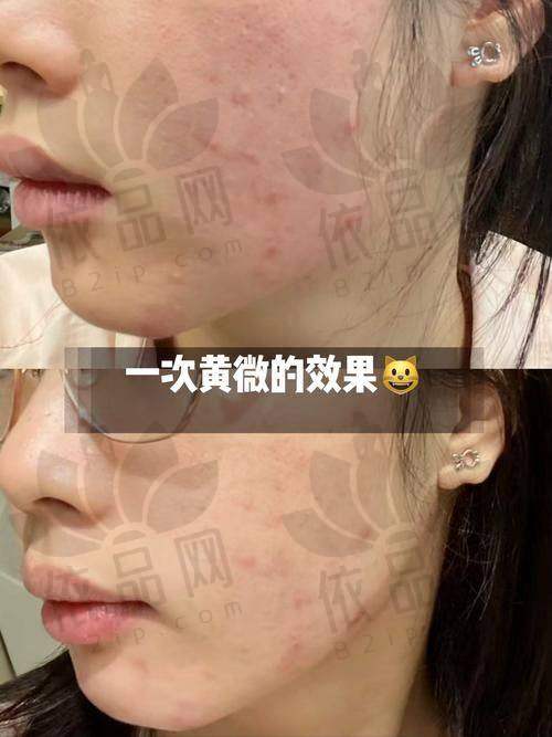 总结