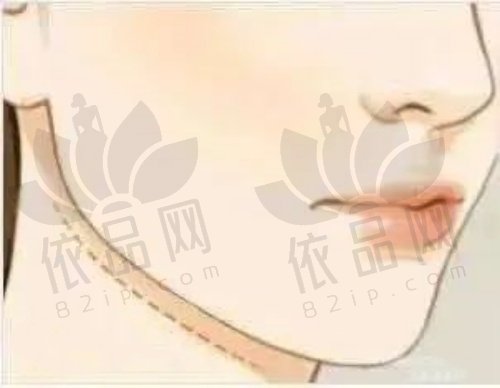 保定华美整形正规医美实力强，彭继忠等医师坐诊，项目多口碑好